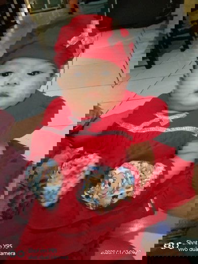 Alergi pada pipi bayik