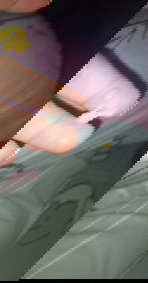 36w1มีอะไรไม่รู้ออกมาจากช่องคลอด