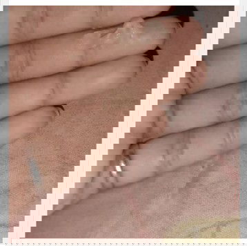 Keputihan putih telur