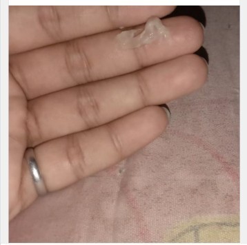 Keputihan putih telur