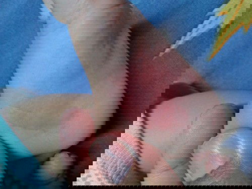 telapak kaki bayi merah