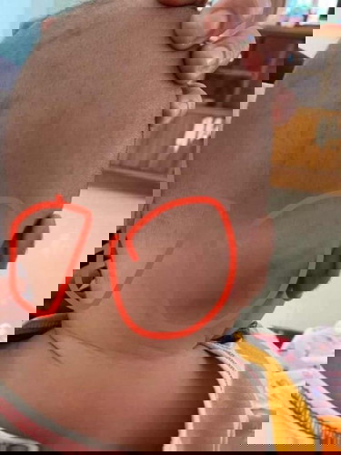 มีคนบอกว่าลูกเป็นเนื้องอกหรือเปล่า?