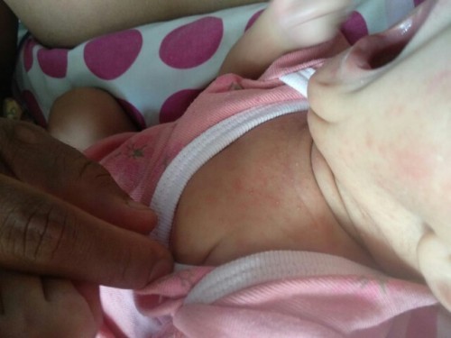 Ada yg pernah kaya gini gakk mom anak nyaa??kira2 kenapa yak mom?