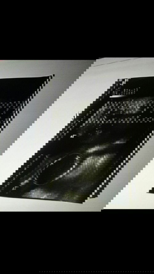 Bingung hpl kehamilan pertama