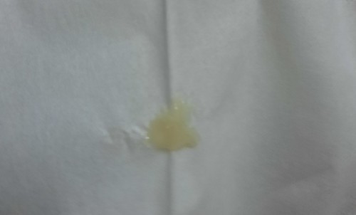 มูกแบบนี้มีโอกาสคลอดไหมค่ะ