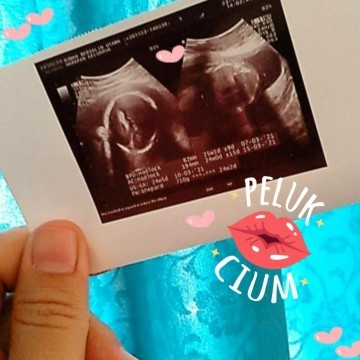 Menanti sangbuah hati