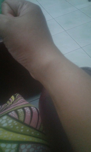 Tulang pergelangan tangan