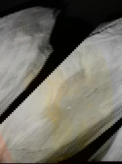 Usia kehamilan UK 39w 6d .