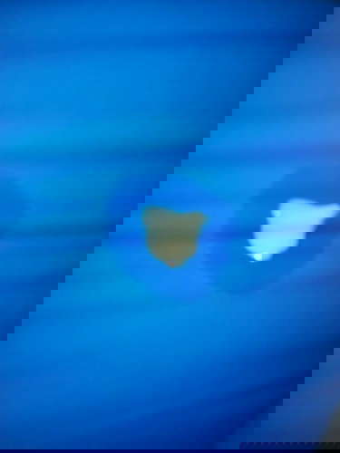 สงสัยว่าเป็นอะไร