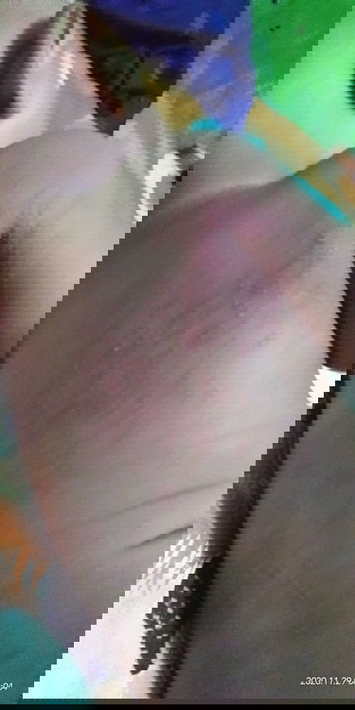 ruam popok apa ini. !?