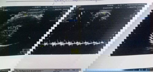 รบกวนช่วยดูให้หน่อยนะค๊ะ ว่าเพศอะไร
คือ..แม่ดูไม่เป็นจริงๆค่ะ