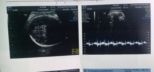 รบกวนช่วยดูให้หน่อยนะค๊ะ ว่าเพศอะไร
คือ..แม่ดูไม่เป็นจริงๆค่ะ