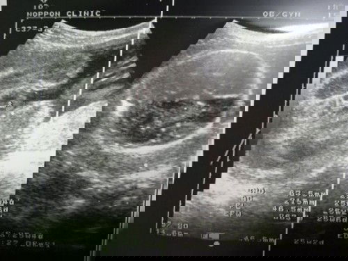 ในภาพแม่ๆว่า