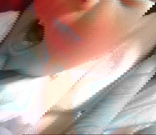 BIBIR ANAK BERCAK PUTIH