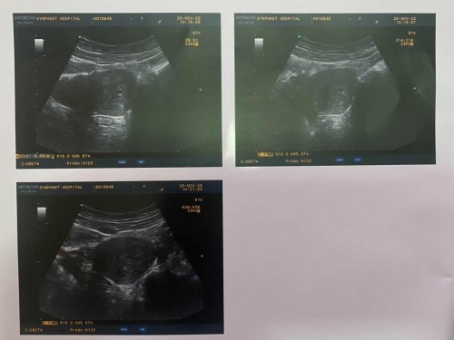 เครียดมากค่ะ ขอคำแนะนำค่ะ