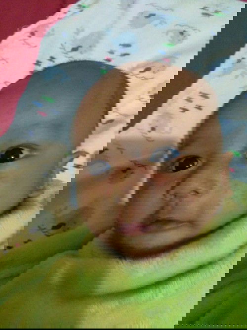 Bintik merah pada wajah