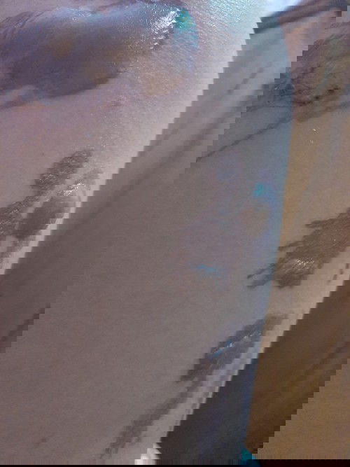 Luka bakar akibat minyakbpanas