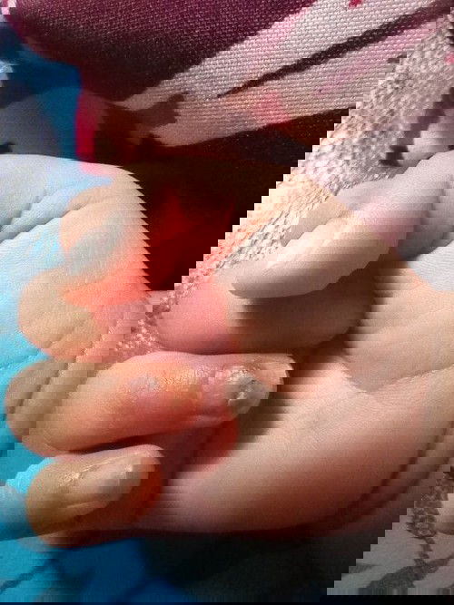 Kuku bayi muncul seperti ini