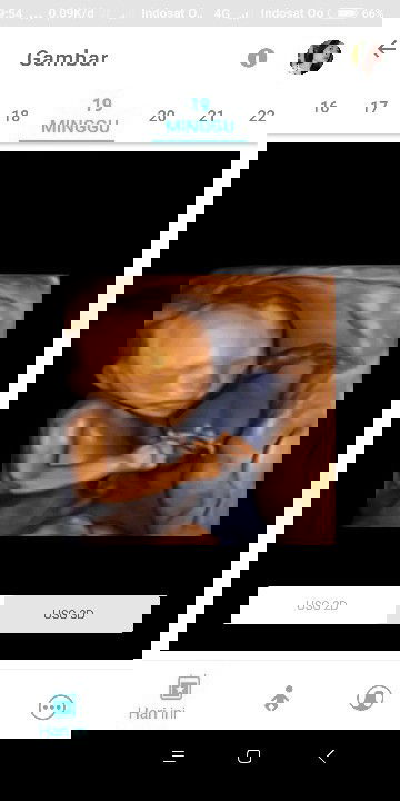 Binggung harga usg 4D takut kemahalan krna orang kurang mampu