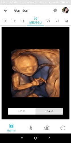 Binggung harga usg 4D takut kemahalan krna orang kurang mampu