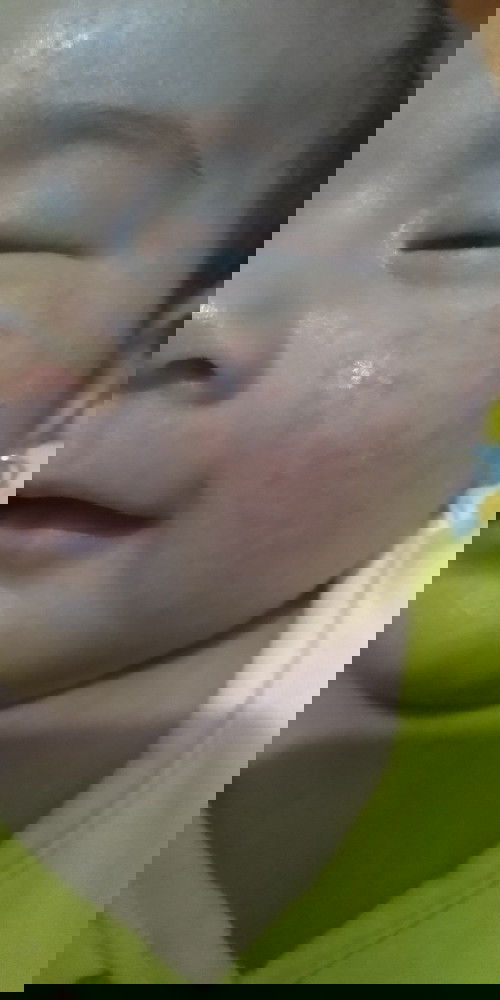 Merah dan Mengelupas