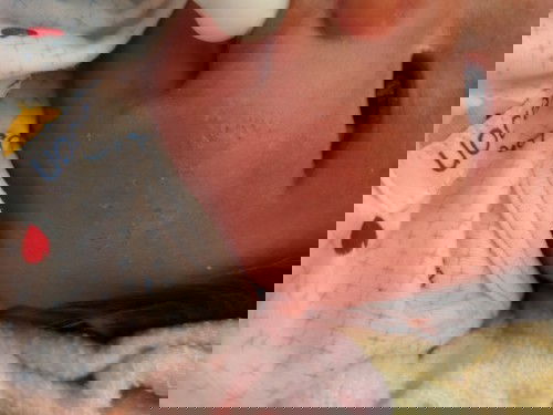 เป็นแผลจากผื่นหรือแก้มแตกคะ