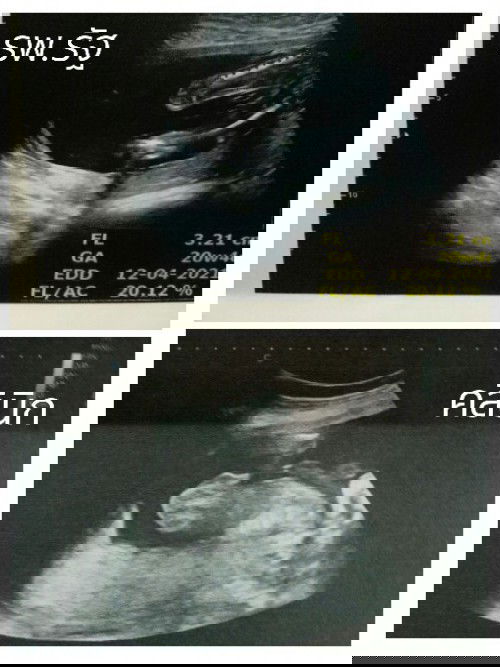 สังเกตเพศยังไงคะ