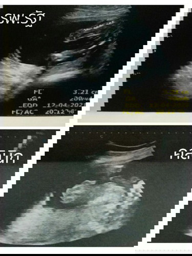 สังเกตเพศยังไงคะ