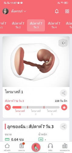 โกรธตัวเองมากเลยค่ะเวลาเเพ้ท้องไม่ชอบกินอะไรเปรี่ยวๆเเต่สิ่งที่อยากกินคืองูเหลือม มันเเปลกใช่ไหมค่ะ
