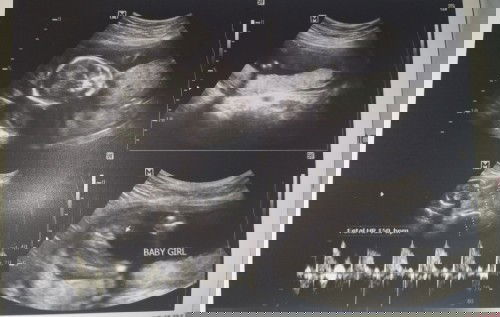 19 weeks and 3 days 👧