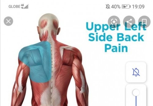 Upper back pain.