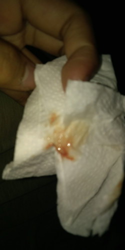 Sign of labor #SIGNOFLABORNAPOBATO