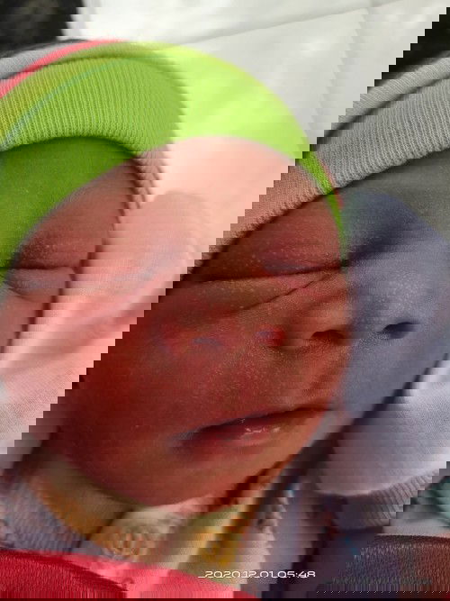 Kulit bayi baru lahir