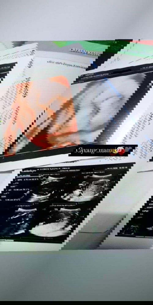 Usg murah seTangerang raya