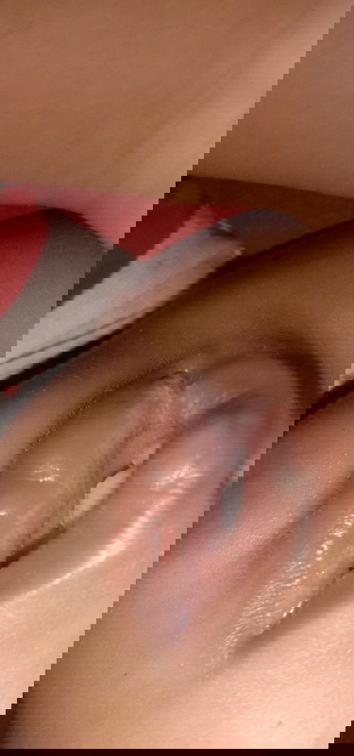 Bibir ada putih putih nya