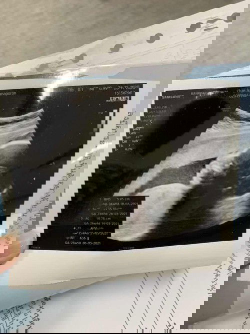 แบบนี้ดั้งโด่งมั้ยคะ หรือยังดูไม่ได้คะว่าโ่ด่งไม่โด่ง