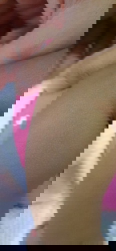 Patches sa skin