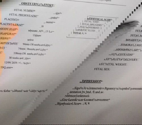 38 weeks,6 days and worried