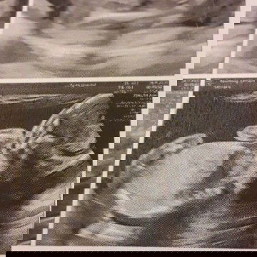 น้อง20สัปดาห์