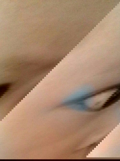 Bercak titik hitam dimata