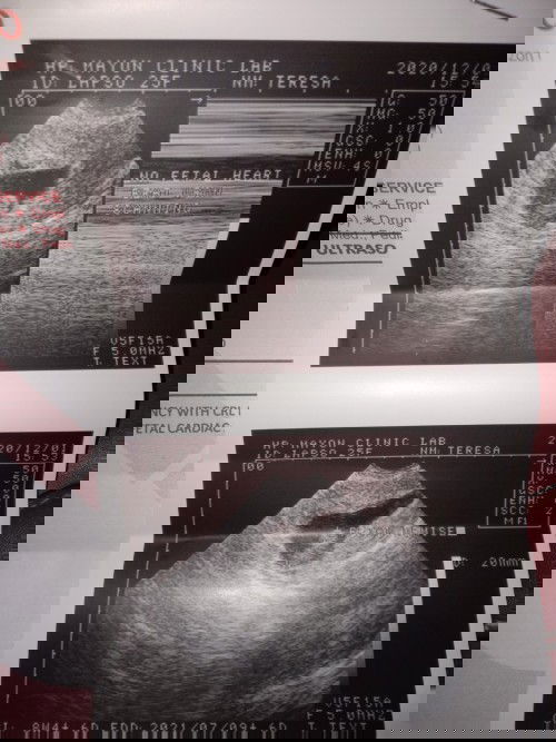 Pregnant for 11 weeks.