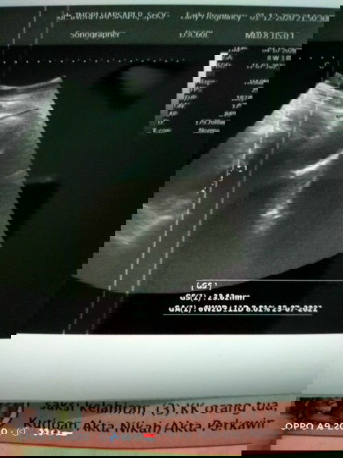 8w apa 6w ya yang bener....baru keliatan kantung janin