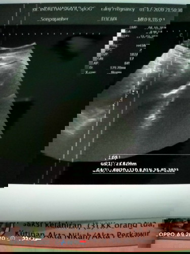 8w apa 6w ya yang bener....baru keliatan kantung janin