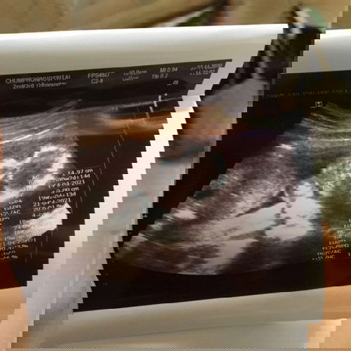 ท้องแรกค่ะ