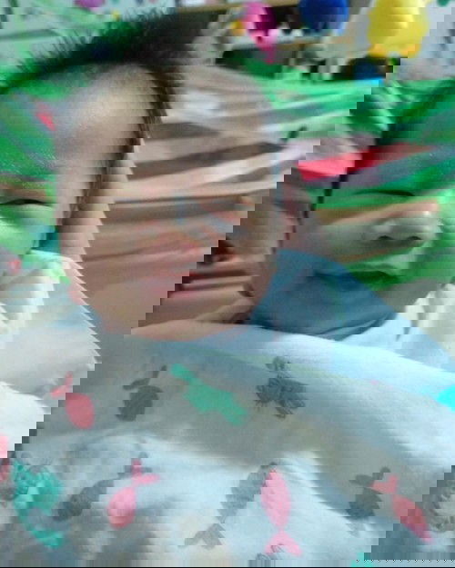 น้องเป็นสะเก็ตตรงระหว่างคิ้ว