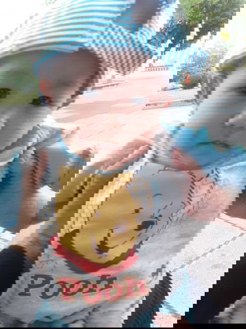 น้องเป็นเกลื้อนน้ำนม ตั้งแต่1เดือน