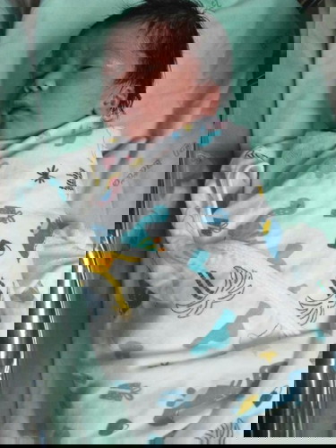 ผ่าตัดด่วน (แพ้ยาเหน็บ 40+2w)