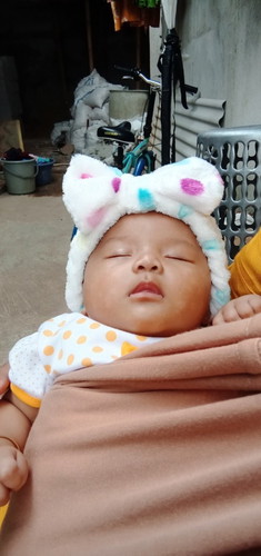 Assalamualaikum Bun mau nnya obat y apa ya kalo pipi y putih bgtu awal y kena asi .