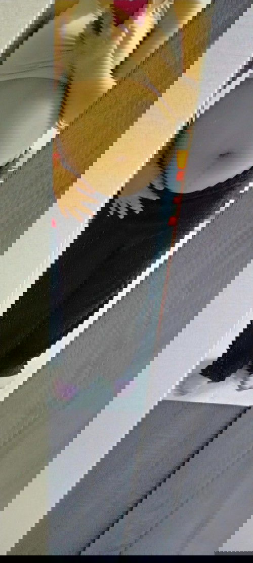 ท้องแตกลายเป็นสีขาวรักษายังไงดีคะ