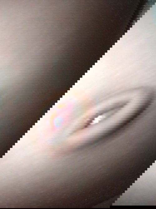 สะดือลูกแบบนี้ปกติมั้ยคะ